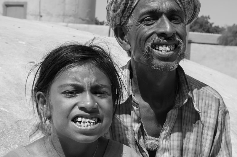 Human Right to Water in Kutch district, Gujarat - Father and daughter suffering from dental fluorosis due to prolonged consumption of fluoride-contaminated water